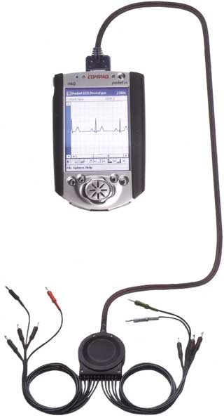 The Pocketview 12 lead ECG Monitor, based on a Pocket PC PDA has been cleared for sale by the FDA.